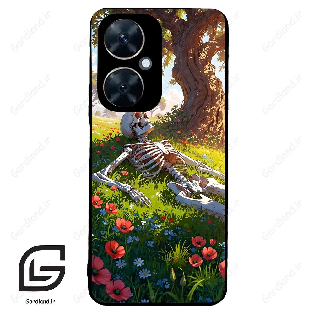 قاب گوشی هوآوی نوا 11i (Huawei Nova 11i ) طرح اسکلت کد 2371