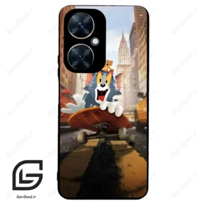 قاب گوشی هوآوی نوا 11i (Huawei Nova 11i ) طرح تام کد 2855